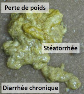 Diarrhée-chez-le-chiot-giardose