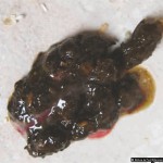 Les protozoaires paraziták de l homme Féreg kezelés Murmanszk